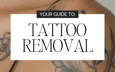 Tattoo Removal: What to Expect, How It Works & How Many Treatments You May Need