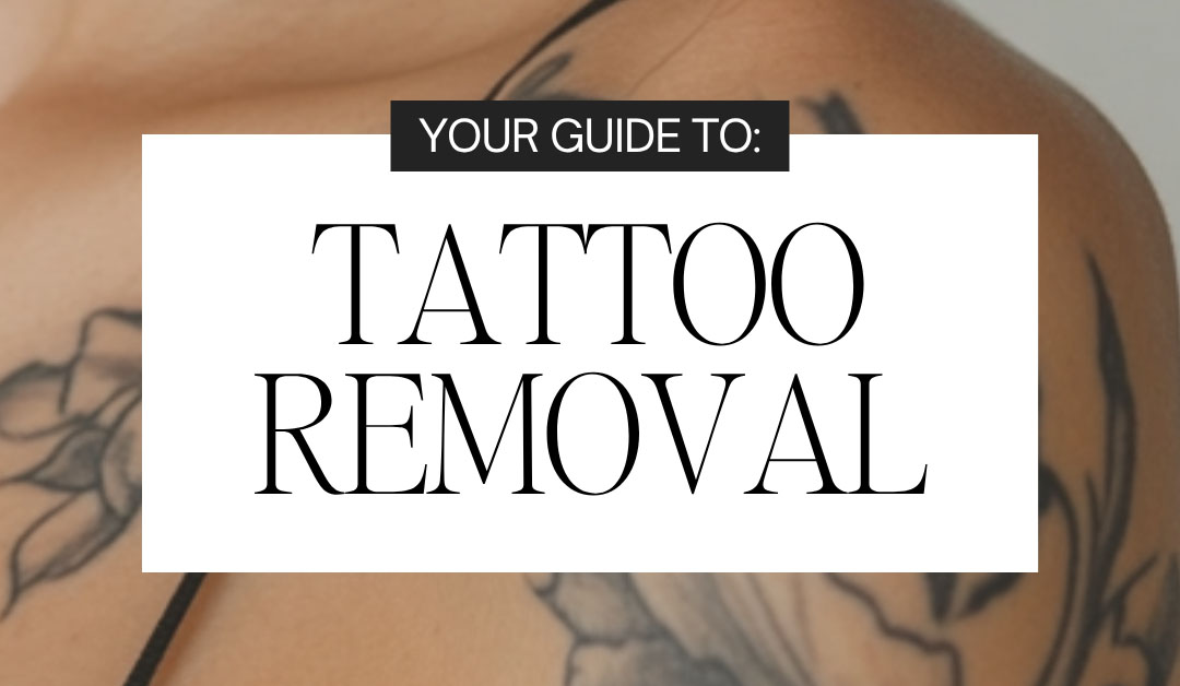 Tattoo Removal: What to Expect, How It Works & How Many Treatments You May Need
